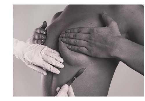 wp_eth_breast_surgery