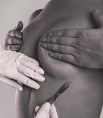 wp_eth_breast_surgery